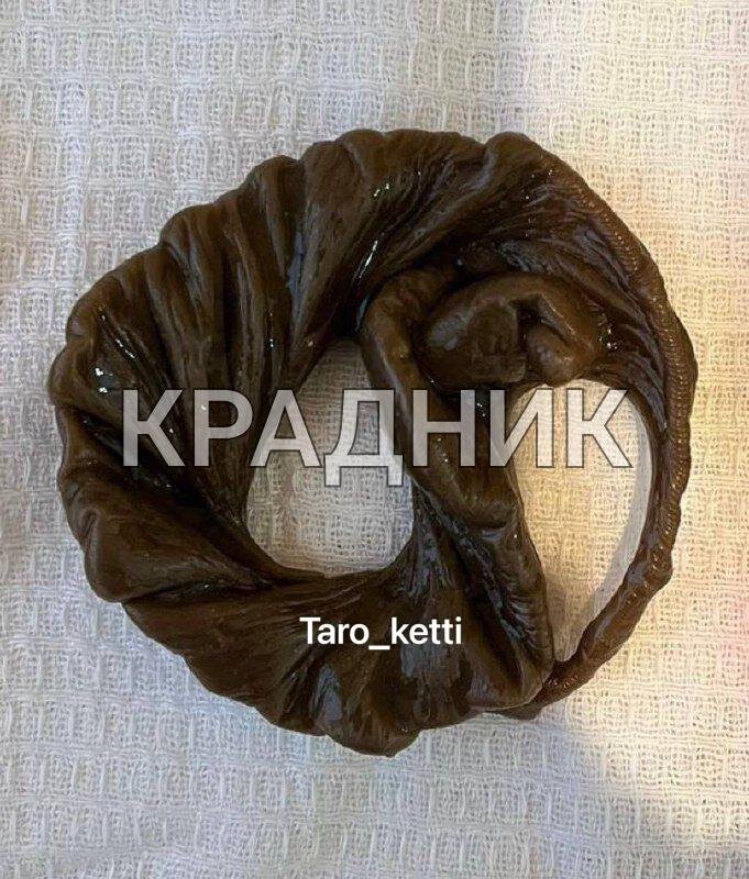 Сегодня поговорим о самом распространенном виде негативного воздействия.
 
Речь пойдет о краднике или крадне (в зависимости от речи региона).
 
Он встречается даже чаще, чем порча (хотя именно настоящая порча, не от шарлатанов - встречается редко, но о ней в другой раз).
 
Крадник - воздействие на биополе человека с целью заполучения части энергии этого человека себе.
 
✅Крадник ставится на: 
-Удачу ; 
-Финансы; 
-Здоровье, здоровье близких; 
-Красоту; 
-Любовь, мужчину и т.д. … 
 
🤯Человек, на котором висит обряд, будет терять то, на что поставлен крадник: 
-Все вдруг стало получаться с трудом или не получаться вовсе; 
-Внезапные траты денег, резкий спад потока клиентов, «одной рукой взяли, другой отдали» и т.д.; 
- Постоянная усталость, непонятные болезни одна за одной, упадок сил и настроения; 
- Внезапные проблемы с кожей, темный цвет кожи лица, высыпания, которых никогда не было и т.д.
 
✅Хорошо видны крадники на диагностических восковых отливках (на фото примеры).
 
Как «получить» крадник:
через обычную человеческую зависть…
Люди видят ваши блага и хотят себе такого же.

Но могут быть и магические крадники: через мантические инструменты, через предметы (подарки).

Подарили вам подарок, он не очень нравится, но отказать неудобно 🙈 
Вот вам и крадник - пока этот «подарок» будет у вас дома, будут неприятности.

Также если обратились за какой-то услугой к Магу и заплатили мало - 
Маг может оставить за собой право взять с Вас то, что ему нужно. 
‼️Помните - в магии бесплатно и дешево - НЕ БЕЗОПАСНО.
 
Как уберечь себя от крадника⤵️
 
💫Чем сильнее биополе человека, тем сложнее сделать на него магическое противоправное действие, которое будет нарушать его свободу.

💫Самый лучший способ - восковые отливки💫 
А затем, уже на чистое поле можно повязывать красную нить 
(со специальным оговором)💫

Записаться на чистку, можно, написав мне в Вотсап или Телеграмм: +79120803010

 
