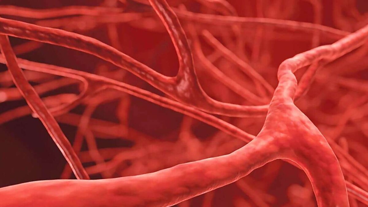 Расширение артериальных сосудов. Стеноз кровеносных сосудов. Суженные кровеносные сосуды.