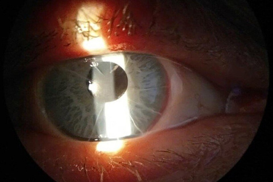    Неотложный кабинет ежедневно принимал десятки пациентов с проблемными глазами. Фото: минздрав КО