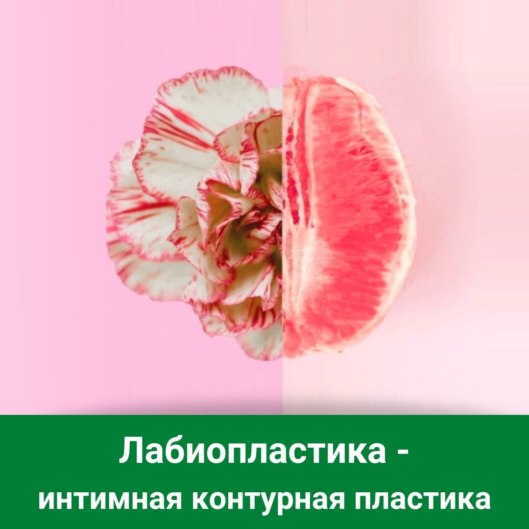 Что такое лабиопластика, или зачем женщины хотят отрезать "там ...