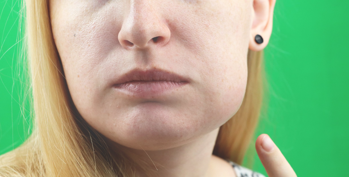 Что делать, если опухла щека: первая помощь и лечение у специалистов