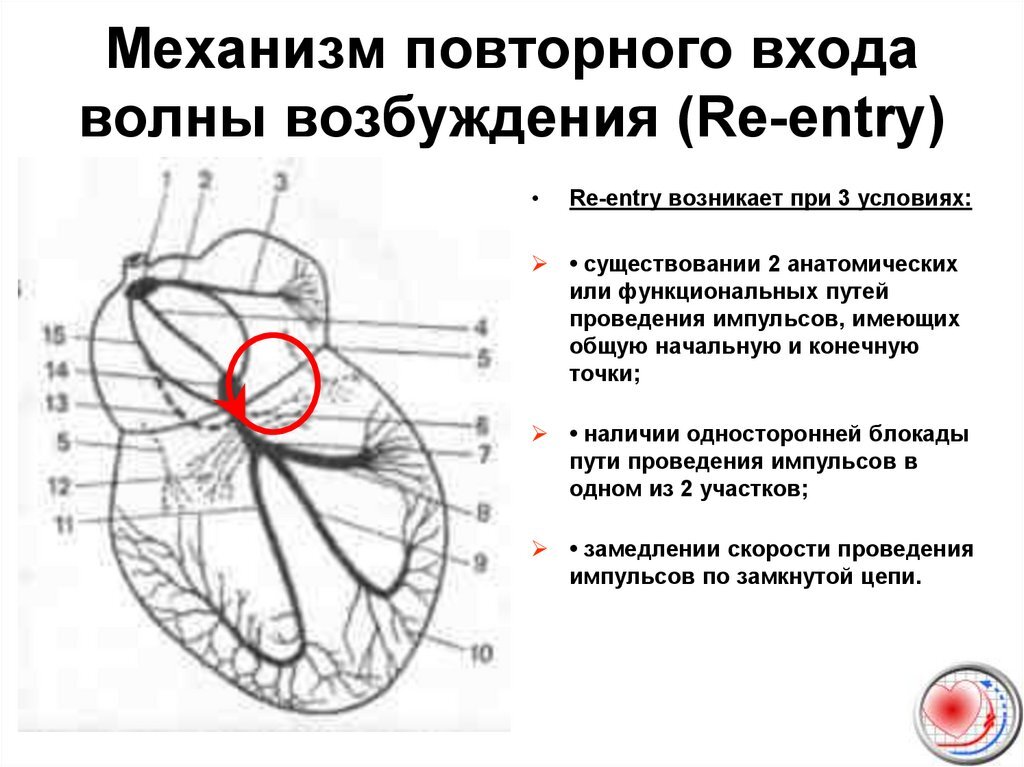 Лечение пароксизмальной наджелудочковой тахикардии - МЦ Класс Клиник