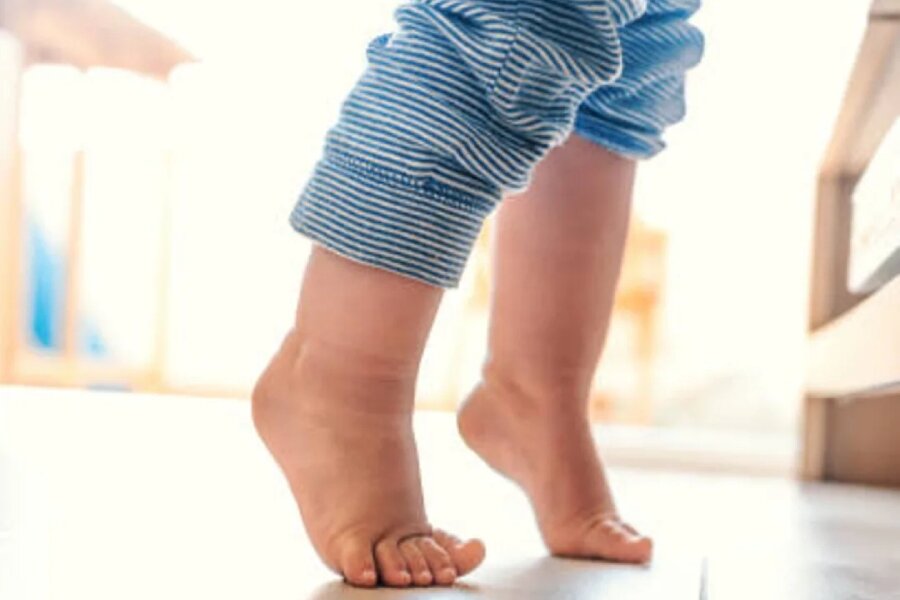 Ребенок на носочках массаж. Ребенок ходит на носочках. Ходьба на носках дети. Ходить на цыпочках. Ребенок на цыпочках.