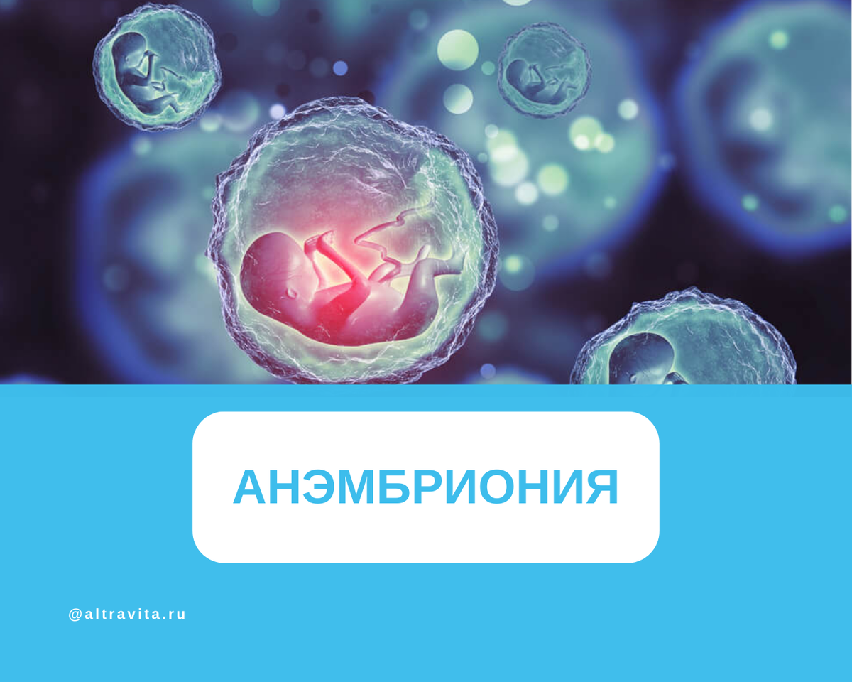 Анэмбриония