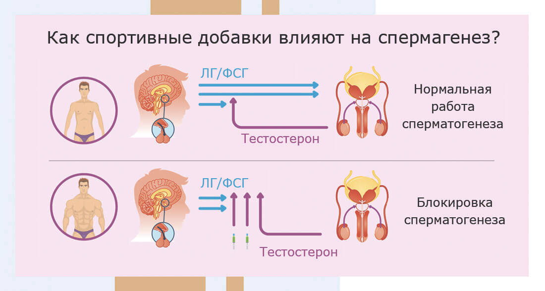 Как улучшить спермограмму - рекомендации врачей