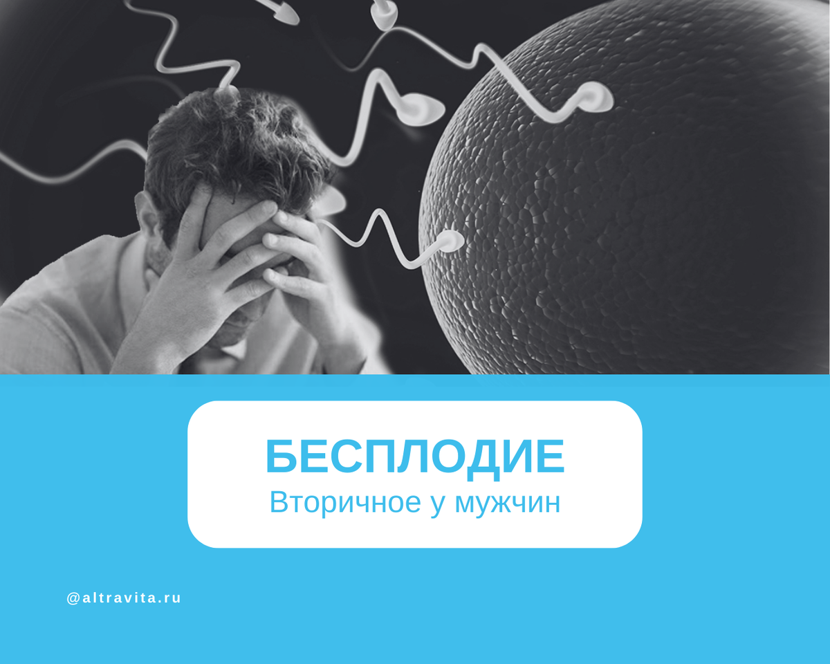 Вторичное бесплодие у мужчин