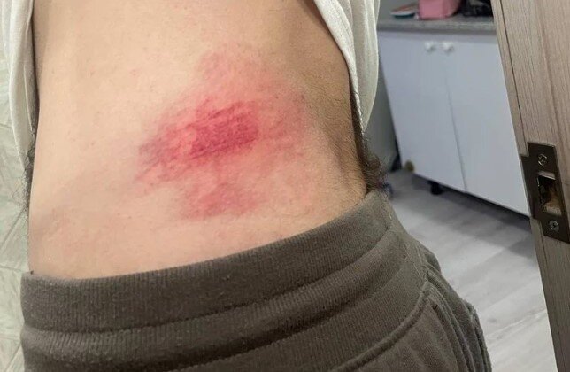 Другое фото демонстрирует глубокое рассечение на голове.