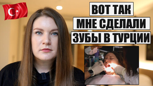 Descargar video: ЧТО СЛУЧИЛОСЬ С ЗУБАМИ ПОСЛЕ ЛЕЧЕНИЯ В ТУРЦИИ, УЖЕ СГНИЛИ? КОРОНКИ, ИМПЛАНТЫ ЦЕНЫ, МОЙ ОПЫТ ЛЕЧЕНИЯ