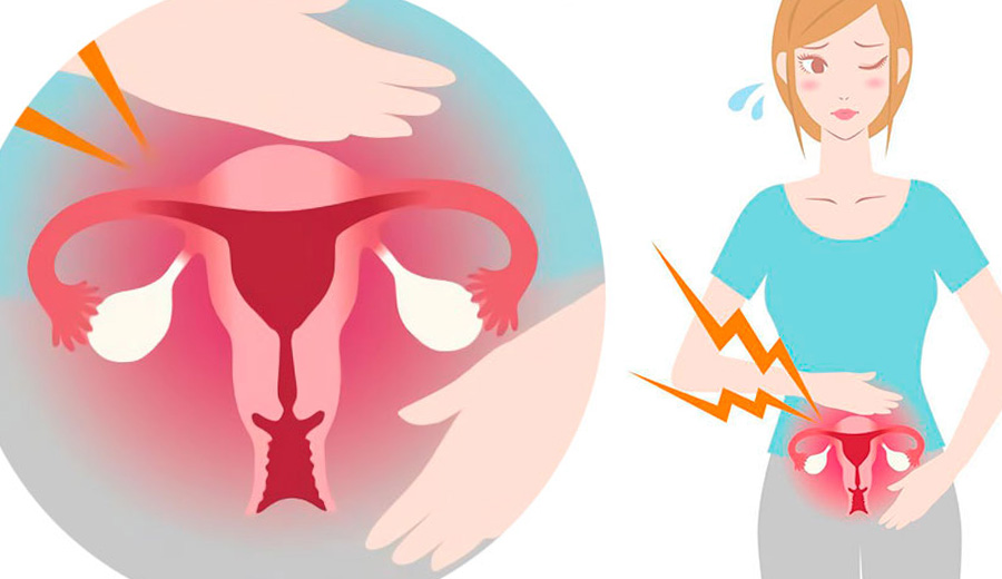 Воспаление матки у женщин симптомы и лечение