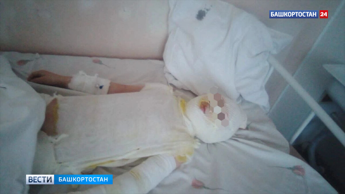 В Башкирии во время купания в бане 10-летний мальчик получил сильные ожоги  | Башкортостан 24 | Дзен
