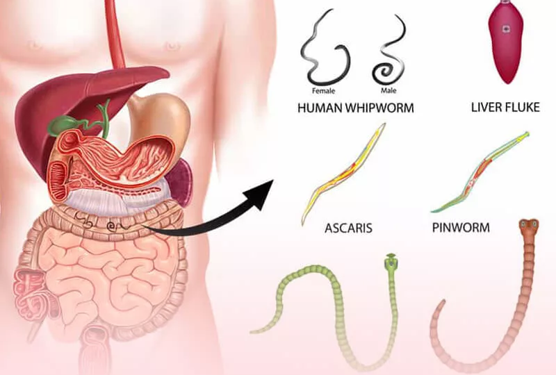 Если глисты, то скрипишь зубами и еще 5 мифов о заражении паразитами