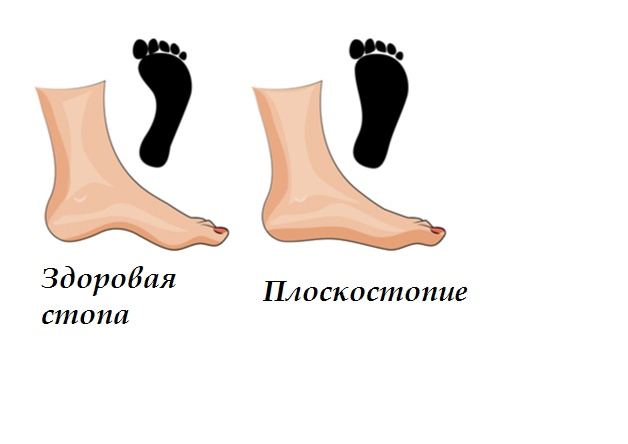 Фотография из интернета.