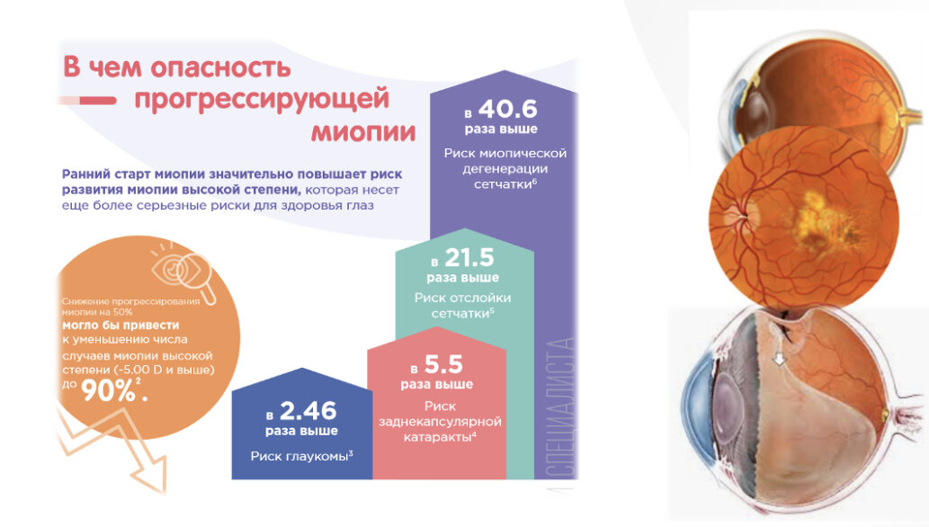 Близорукость становится все более распространенной во всем мире. Это недооцененная, но ведущая причина слепоты, особенно среди населения трудоспособного возраста. Близорукость часто считается доброкачественной, поскольку ее легко исправить с помощью очков, контактных линз или рефракционной хирургии. Традиционно близорукость подразделяют на физиологические и патологические подтипы в зависимости от степени имеющейся близорукости. Более высокие уровни близорукости связаны с повышенным риском патологических осложнений, но важно отметить, что безопасного уровня близорукости не существует.  Даже слабая степень миопии увеличивает риск отслойки сетчатки и других сопутствующих заболеваний глаз, которые будут подробно рассмотрены позже. Самое серьезное осложнение, миопическая макулопатия, является единственной ведущей причиной слепоты без установленного лечения и, следовательно, приводит к неизбежной потере зрения у некоторых миопов даже в молодом возрасте.
