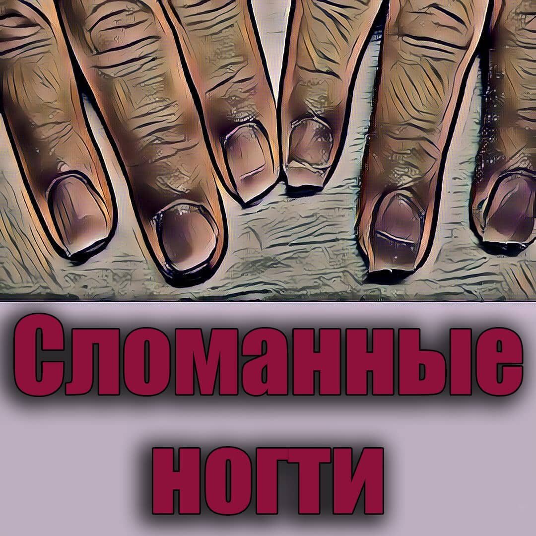 Сломанные ногти | FeelingViking | Дзен