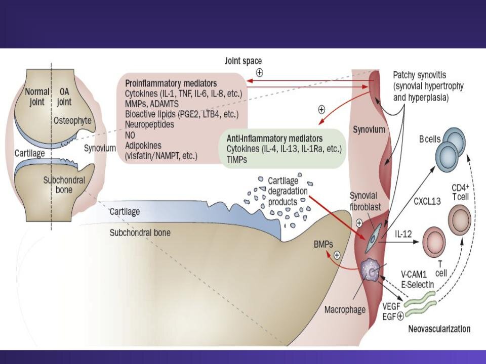 Примерное количество клеток, участвующих в воспалительном процессе при остеоартрите. 