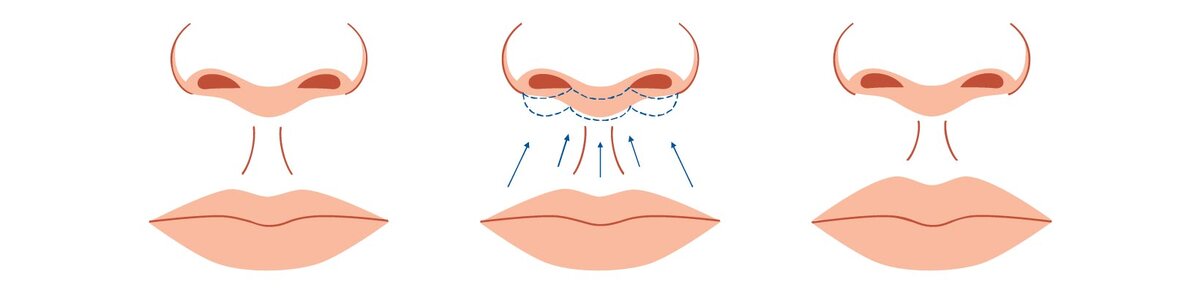 В иллюстративных целях. Foto by Legion Media