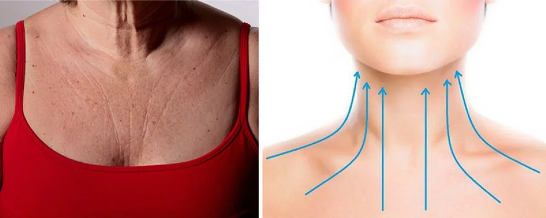 Шея не выдаст ваш возраст: как ОМОЛОДИТЬ ШЕЮ в домашних условиях