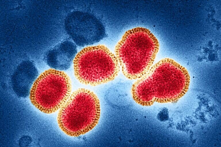    Окрашенная электронная микрофотография частиц вируса гриппа А (H3N2) / © NIAID / Flickr