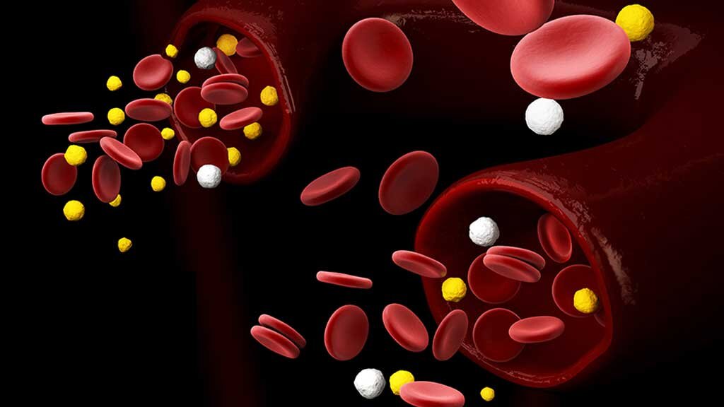 Глюкоза в крови.