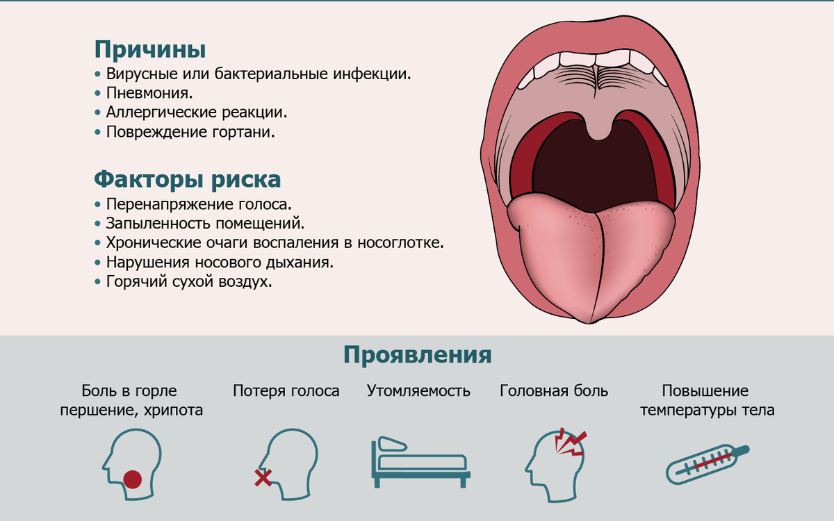 Ларингит – симптомы, признаки, причины, виды и лечение у взрослых в «СМ-Клиника»