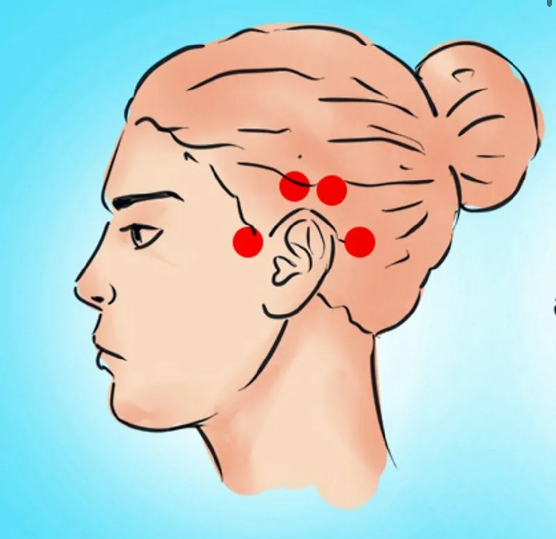Боль головы над ухом. Болевые точки на лбу. Точки на висках. Болезненные точки на висках. Болевая точка на подбородке.