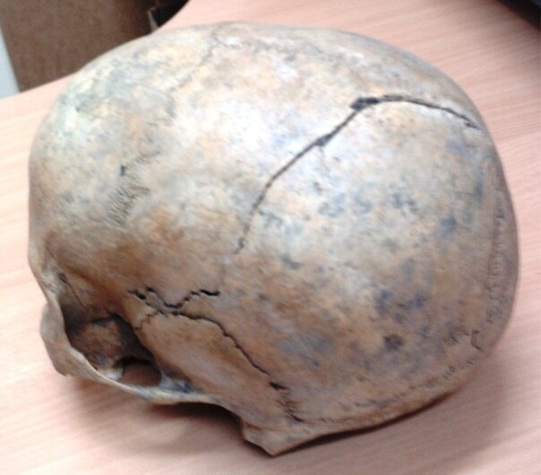 Женский череп, убита, видимо, сабельным ударом сверху-сзади
