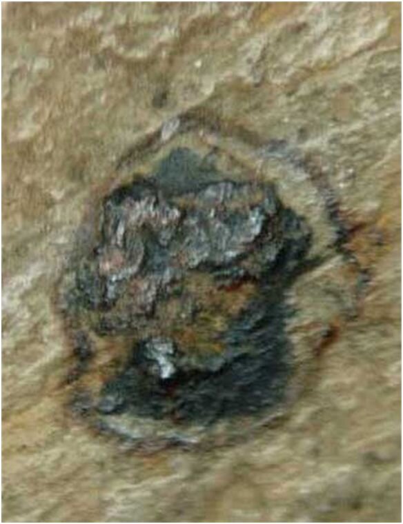 Рис. 2. Металлическая частица в бивне мамонта, окруженная обожженным кольцом [1]