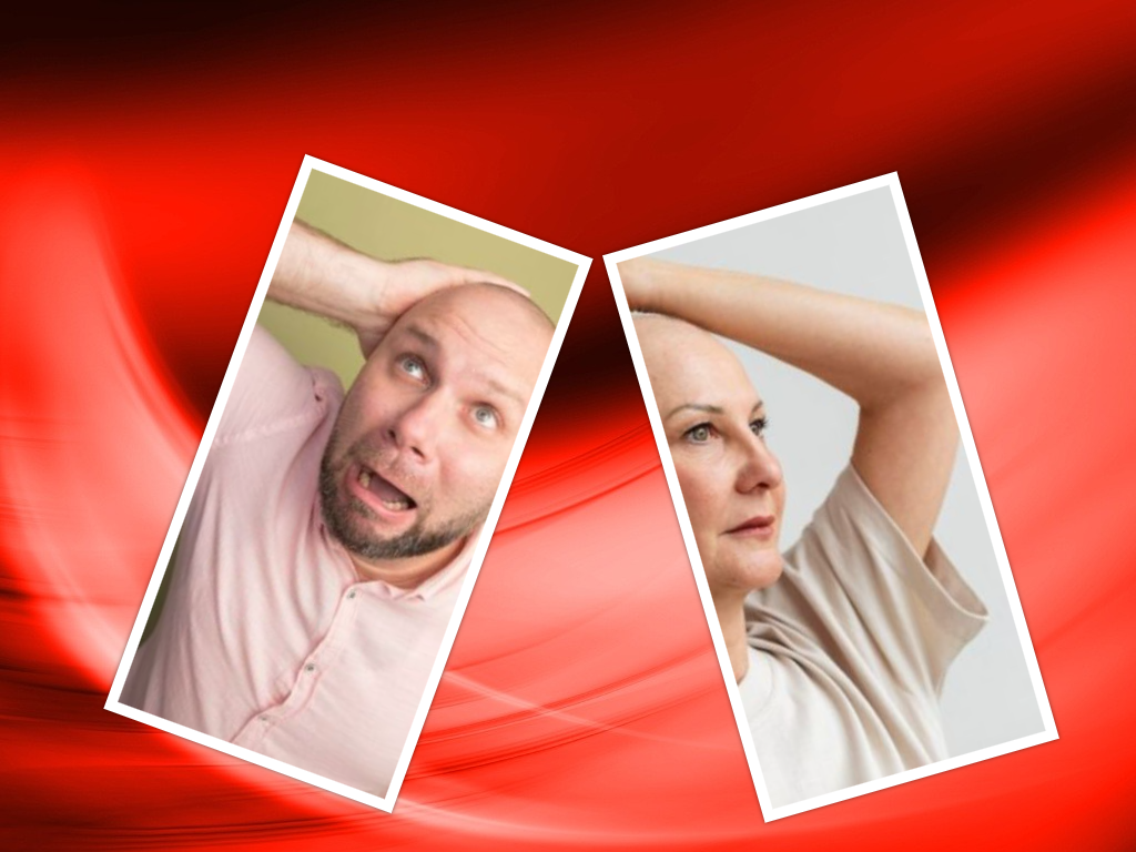 Alopeсia - в переводе с греческого означает выпадение волос, как у линяющей лисы. Иными словами, этот медицинский термин подразумевает потерю волос полную или частичную, постоянную или временную. Не следует наивно полагать, что это заболевание, от которого страдают исключительно мужчины. И хотя статистика утверждает, что среди сильного пола в тридцать лет волосы теряет каждый третий, в пятьдесят – каждый второй, а в восемьдесят – 80%, женщины тоже хорошо знают, что это такое.