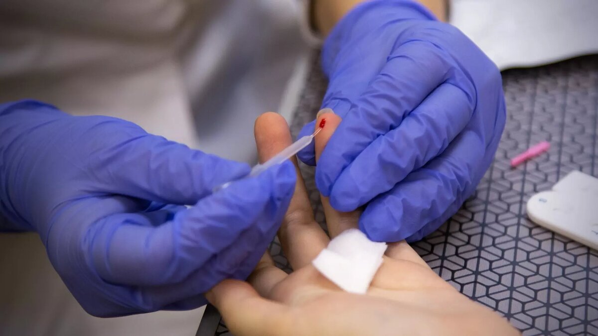     ВИЧ-инфекцию в 2023 году выявили почти у одной тысячи жителей Тюменской области. В числе заболевших — не менее 13 подростков. Такие данные предоставили в управлении Роспотребнадзора по Тюменской области.