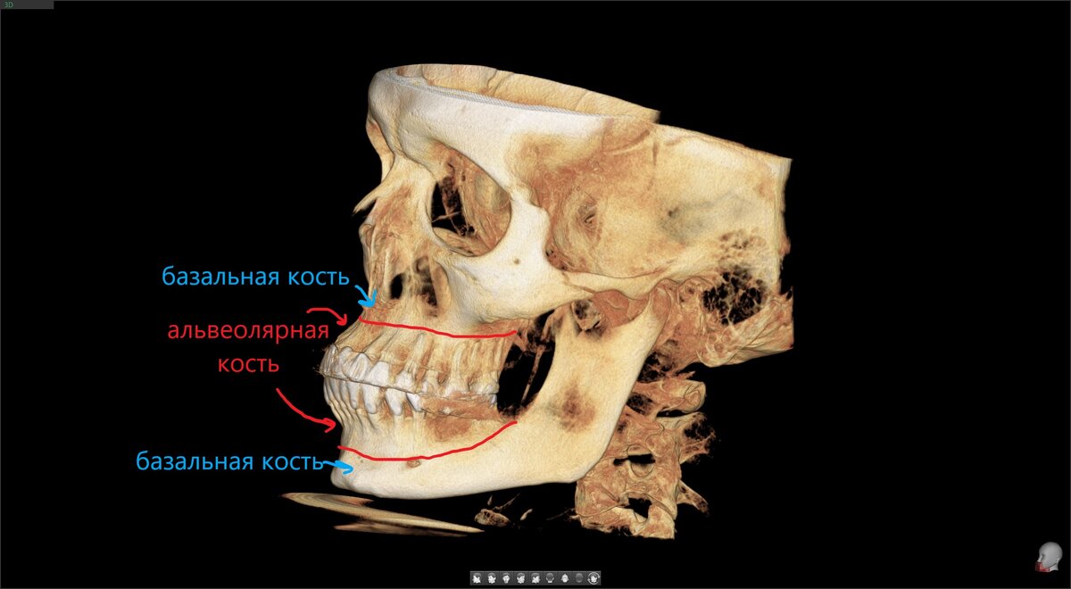 Базальная и альвеолярная кость