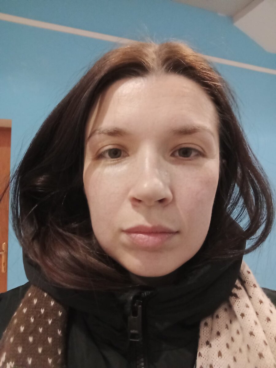 вышла после процедуры. кожа розовая)