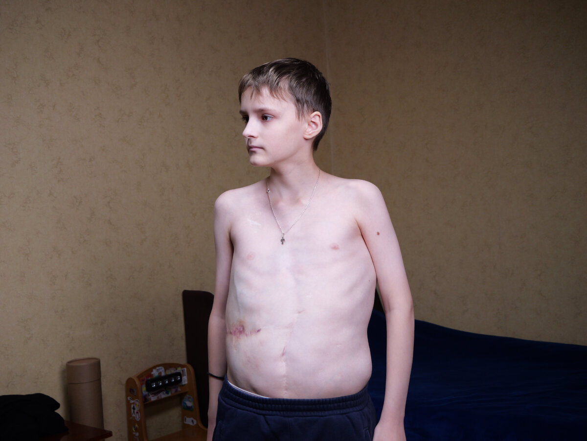 Илья Бусаров, подопечный фонда "Алёша"