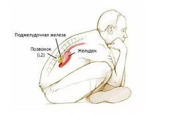 Вынужденная поза больного