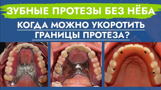 К чему снятся вставные зубы?