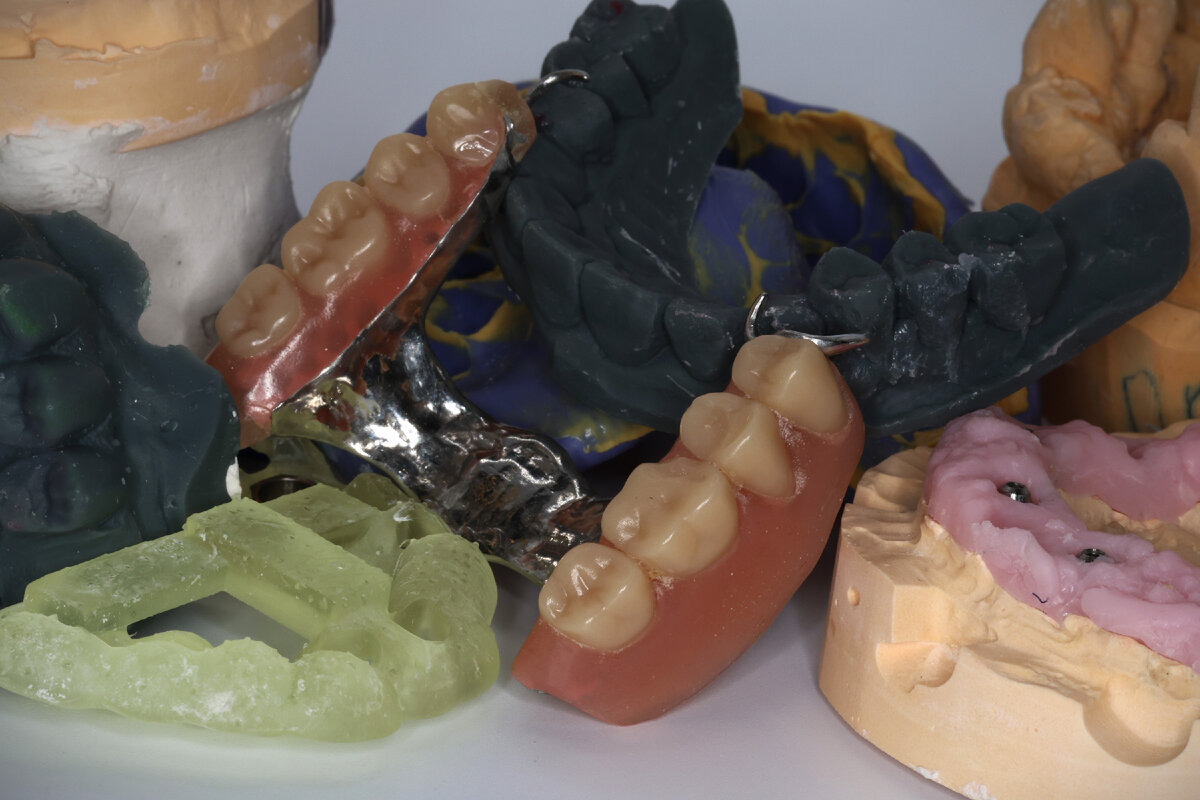 Протезы, макеты, распечатки - на любой вкус 