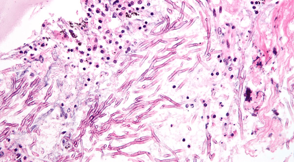   Nephron / Wikimedia Commons / CC BY-SA 3.0 DEED