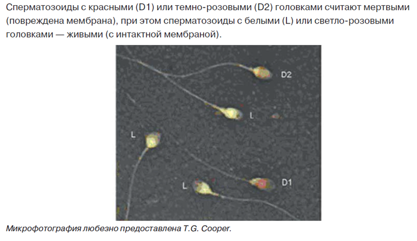 Красный и темно-розовый цвет обозначают мертвые сперматозоиды, а светло-розовые и белые представляют живые сперматозоиды. Руководство ВОЗ, 2010.