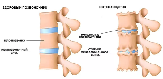 
Когда у нас появляются боли в спине, мы чаще всего связываем их появление с какой-то чрезмерной физической нагрузкой. На самом деле всё не совсем так.-3