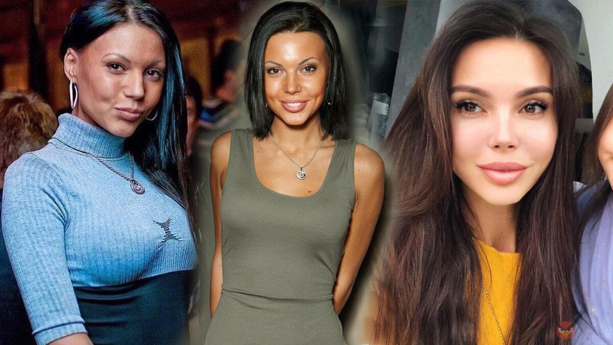 Оксана Самойлова до пластики (слева и в центре) и после (справа)