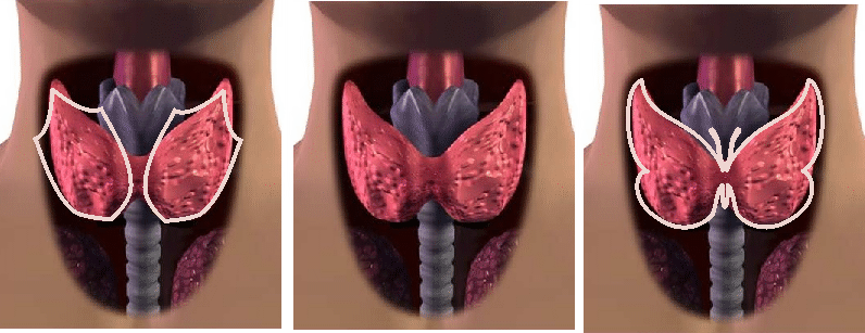 А еще многие сравнивают щитовидку с бабочкой. Тоже логично!