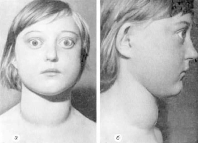 Мне кажется именно такая фотография была в учебнике биологии. Или что-то очень похожее. 