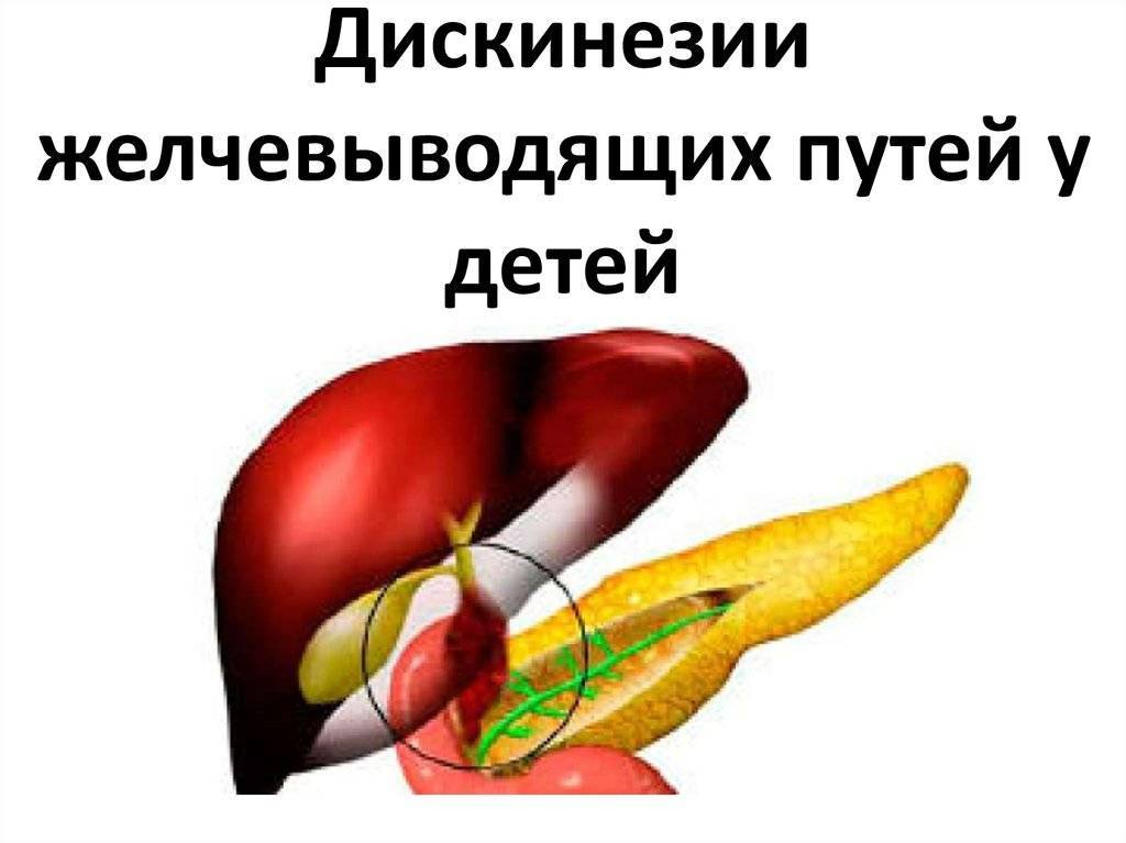 Джвп боли. Джвп. Дискинезия желчевыводящих путей. Дискинезия ЖВП. Дискинезия желчных путей.