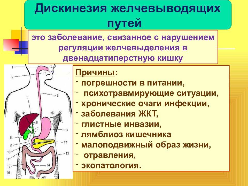 Нарушение по боковой стенке. Дискинезия желчевыводящих путей. Дискинезия желчевыводящих путей симптомы. Дискинезии желчевывод. Путей. Причины дискинезии желчевыводящих путей.