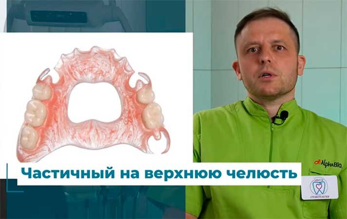 Частичный на верхнюю челюсть 