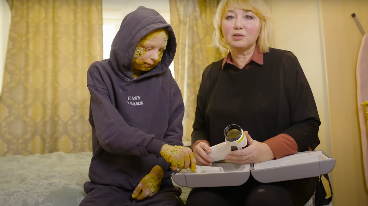 Кирилл с Бабушкой и специальной лампой для кожи