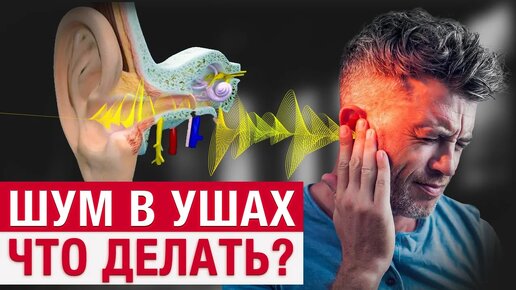 Как БЫСТРО избавиться от шума в ушах? / Массажная техника при звоне в ушах!