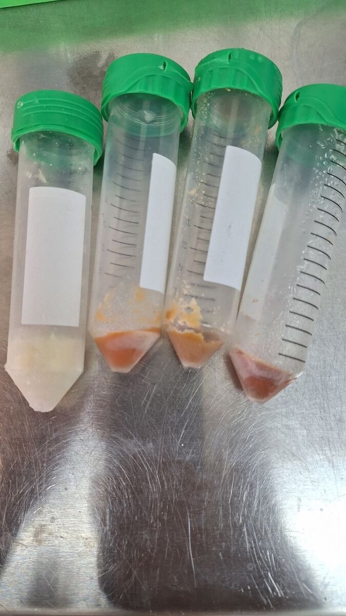 А еще эту отчаянно зеленую массу (2-е место в мире по удельному содержанию хлорофилла) можно превратить в любой оттенок розового, белого и оранжевого. И даже не надо заливать все подряд гексаном, как на производстве соевого изолята