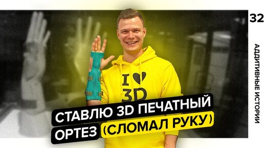 Ломаю руку и ставлю 3D печатный ортез | Аддитивное лечение