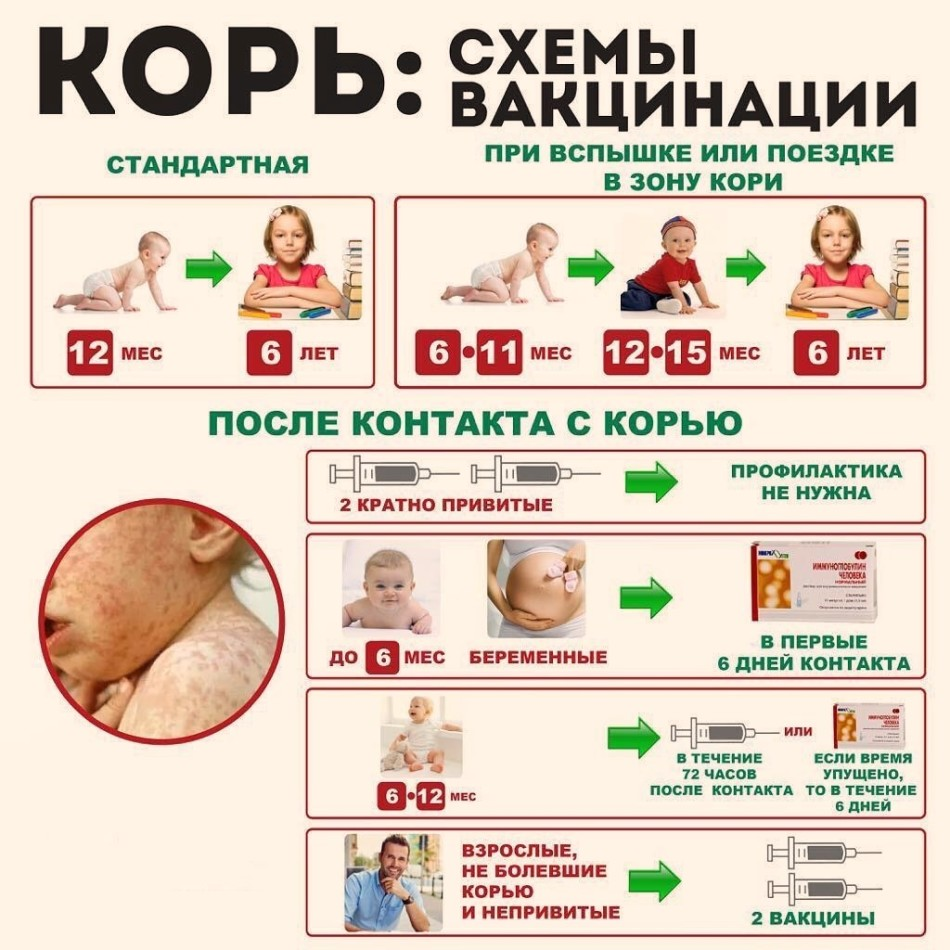 Схема корь корь вакцинация. Прививка против кори схема. Вакцинация против кори проводится. Корь краснуха паротит схема ревакцинации. Прививка от кори можно пить