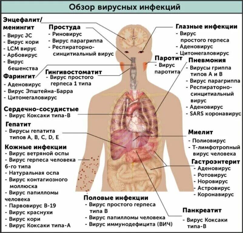 К чему может привести инфекция. Болезни человека вызываемые вирусами. Виды болезней вызванные вирусами. Вирусы которые вызывают болезни человека. Вирусы полезные для человека.